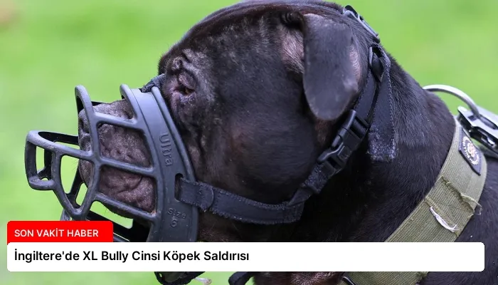 İngiltere’de XL Bully Cinsi Köpek Saldırısı