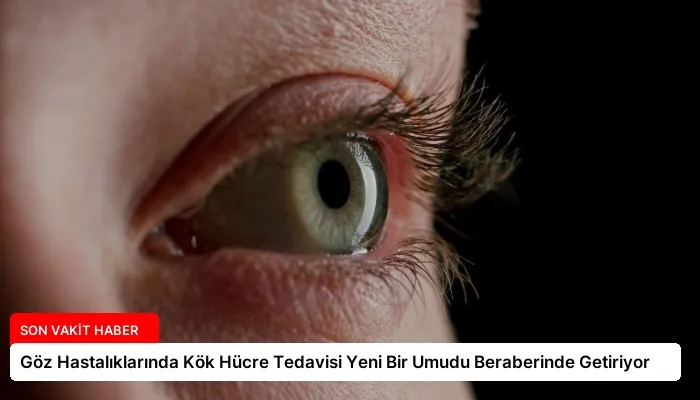 Göz Hastalıklarında Kök Hücre Tedavisi Yeni Bir Umudu Beraberinde Getiriyor