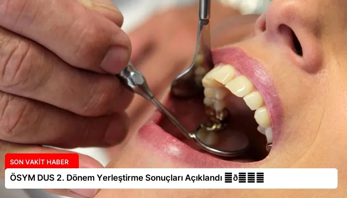 ÖSYM DUS 2. Dönem Yerleştirme Sonuçları Açıklandı ⏬👇
